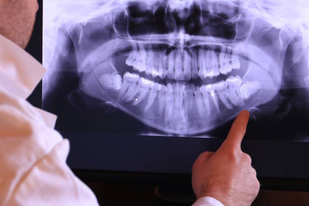 Best Emergency Dental Services for Seniors in Beachwood, OH